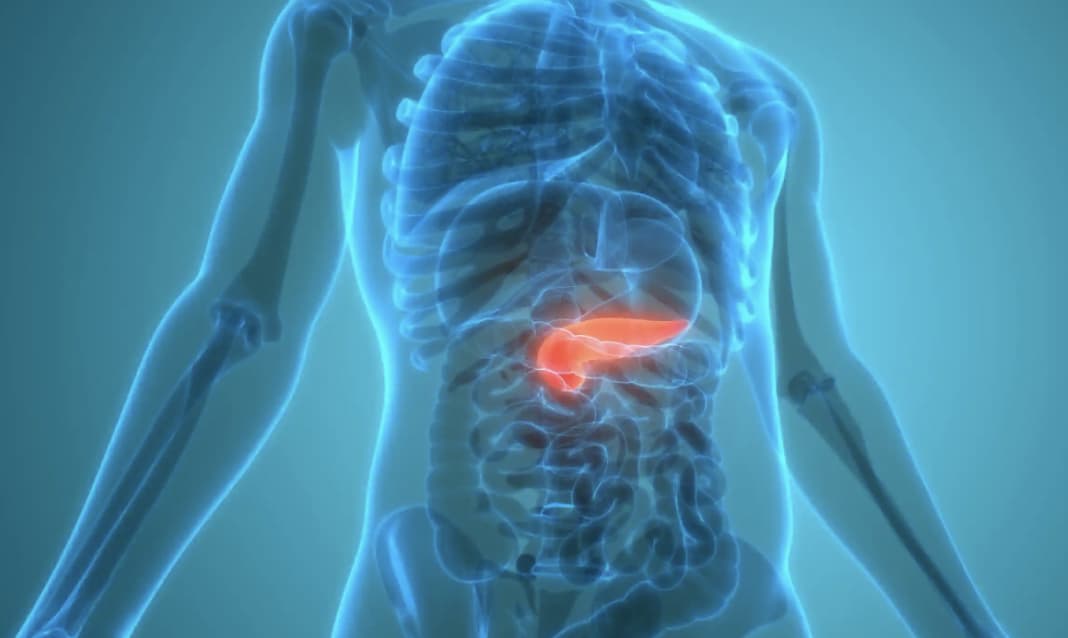 Công nghệ AI đột phá giúp phát hiện sớm “vua của các bệnh ung thư”